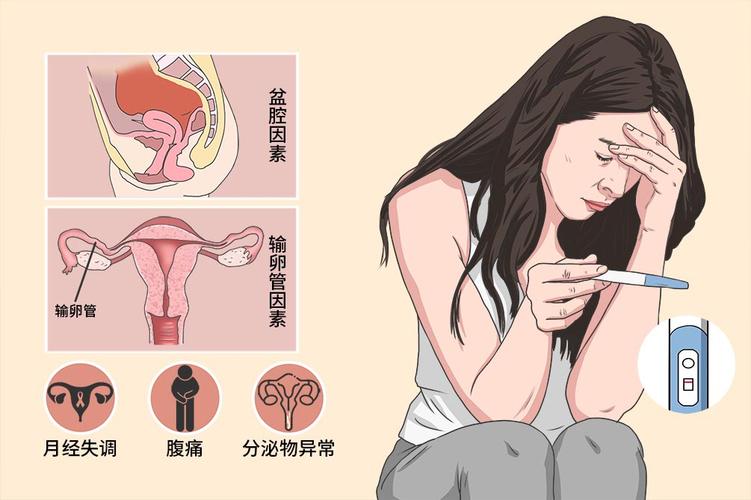 女性不孕不育症要检查哪些项目 女性不孕不育症要检查哪些项目