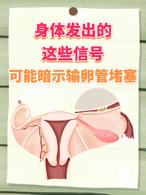 输卵管不孕不育的症状有哪些 - 百度宝宝知道 输卵管不孕不育的症状有哪些 - 百度宝宝知道