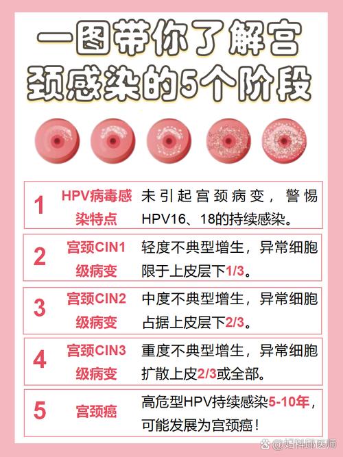 常见的宫颈疾病都有哪些? 常见的宫颈疾病都有哪些?