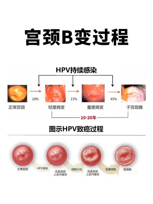 常见的宫颈疾病都有哪些? 常见的宫颈疾病都有哪些?
