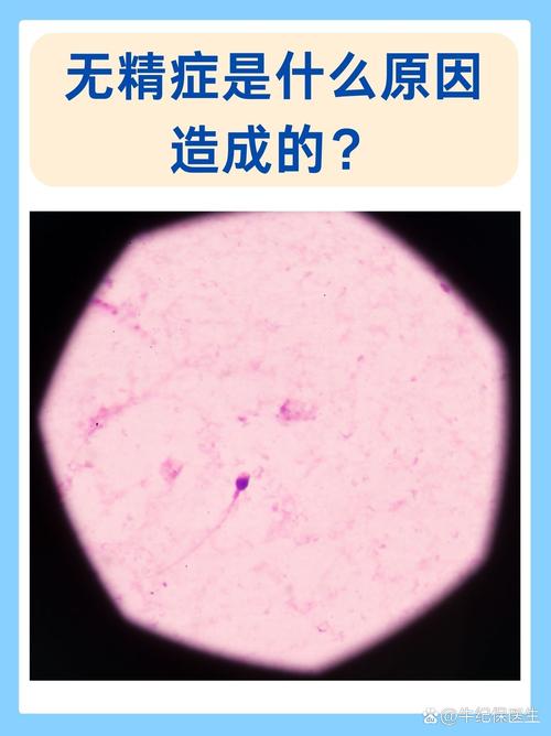 男人无精症有什么症状表现
