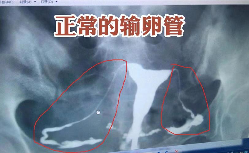 女人不能生孩子的原因 女人不能生孩子的原因