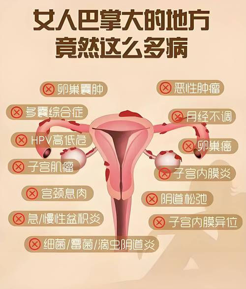 妇科病有哪些种类它们的症状是什么 妇科病有哪些种类它们的症状是什么