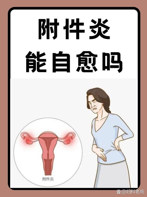 女性妇科疾病有哪些 女性妇科疾病有哪些