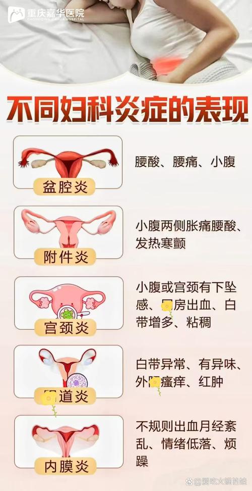 常见的妇科病有哪几种 常见的妇科病有哪几种