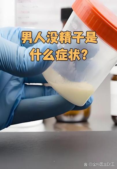 高同型半胱氨酸血症诊疗专家共识(中)