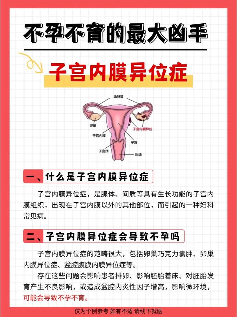 广州不孕不育咨询电话? 广州不孕不育咨询电话?